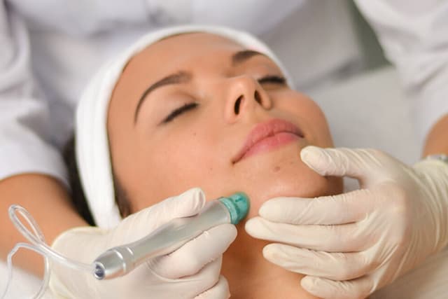 HydroDermabrasion Facial Service Image